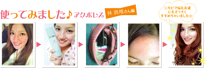 使ってみました♪アクポレス