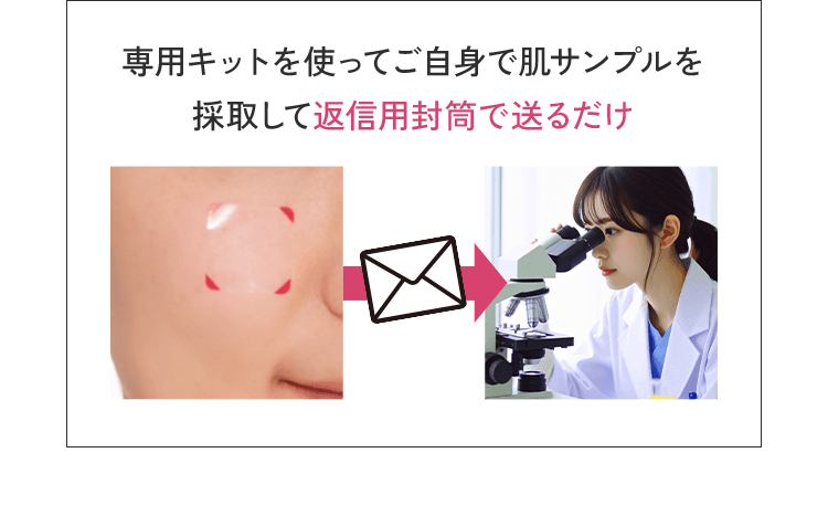 専用キットを使ってご自身で肌サンプルを採取して返信用封筒で送るだけ