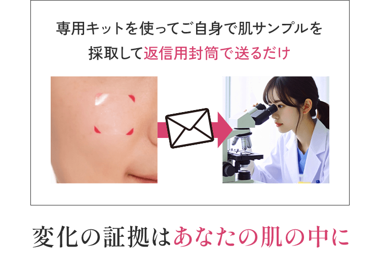 専用キットを使ってご自身で肌サンプルを採取して返信用封筒で送るだけ