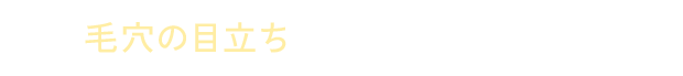 毛穴の目立ちが気になる