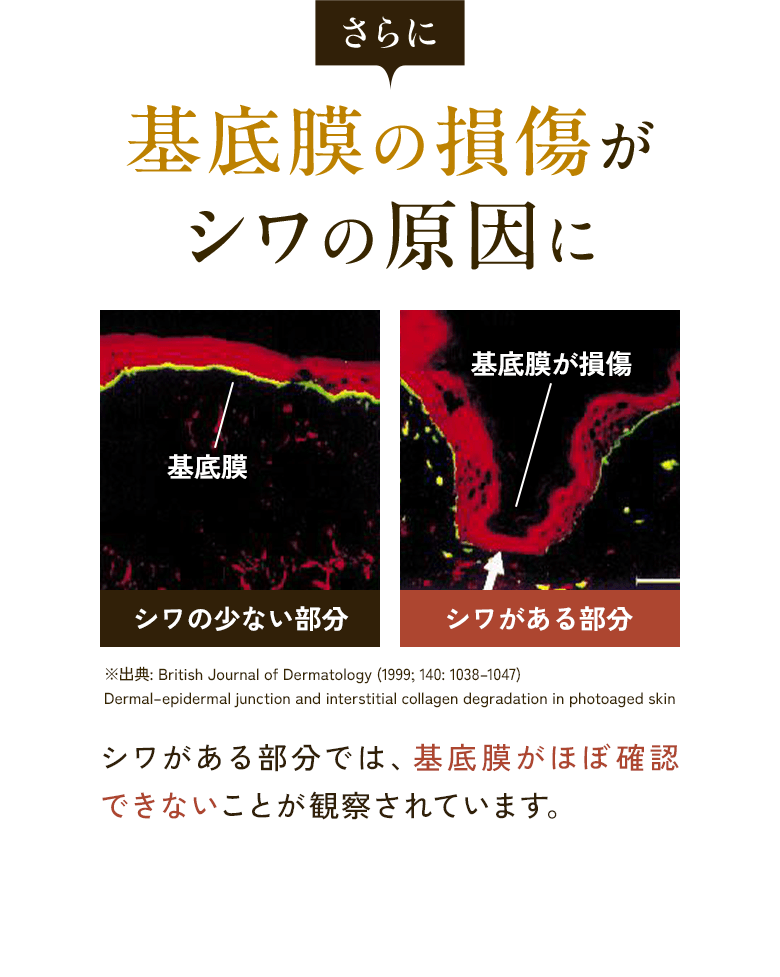 さらに 基底膜の損傷がシワの原因に 基底膜 シワの少ない部分 基底膜が損傷 シワがある部分 ※出典: British Journal of Dermatology (1999; 140: 1038-1047) Dermal-epidermal junction and interstitial collagen degradation in photoaged skin シワがある部分では、基底膜がほぼ確認できないことが観察されています。