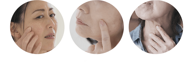 頬のシミ・口元のたるみ・首のシワなど年齢肌に悩む女性 ※1 2026年6月末時点 ※2 2002年~2025年のライスフォースの累計出荷数から算出