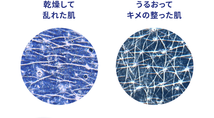 乾燥して乱れた肌 うるおってキメの整った肌