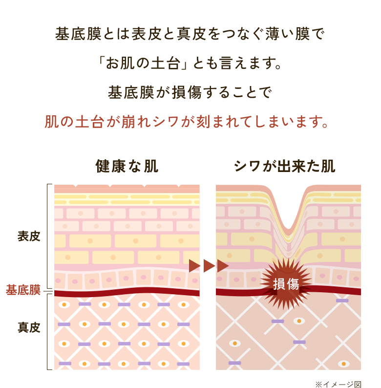 基底膜とは表皮と真皮をつなぐ薄い膜で「お肌の土台」とも言えます。基底膜が損傷することで肌の土台が崩れシワが刻まれてしまいます。健康な肌 シワが出来た肌 表皮 基底膜 真皮 損傷 ※イメージ図